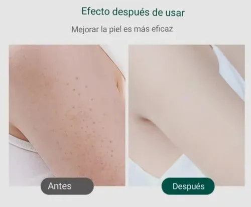 Exfoliante Corporal Áloe